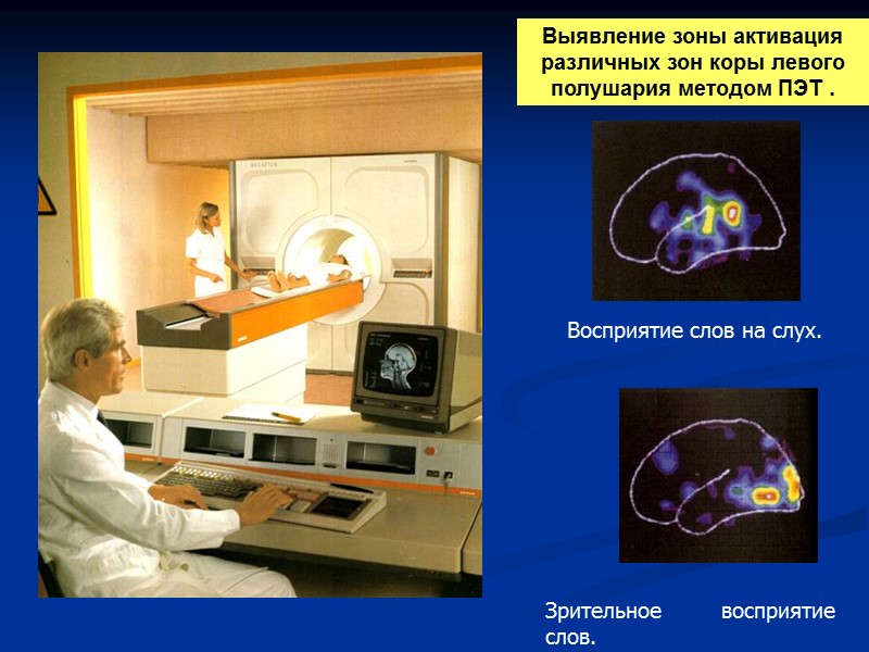 Выявление зоны активация различных зон коры левого полушария методом ПЭТ . Восприятие слов на
